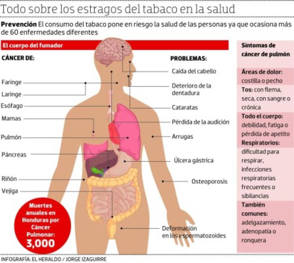 Cerca del 40% de la población es fumadora en Honduras. El consumo de tabaco mata cada año a casi seis millones de personas alrededor del mundo. Según previsiones, para 2030 aumentará a ocho millones de fallecimientos anuales. El lema de la OMS para el Día Mundial sin Tabaco 2017 es: “El tabaco, una amenaza para el desarrollo'.