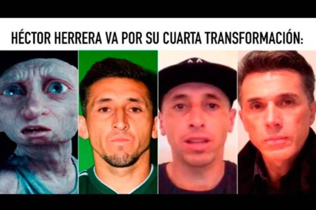 Despiadada ola de memes contra Héctor Herrera tras su cirugía en nariz y orejas