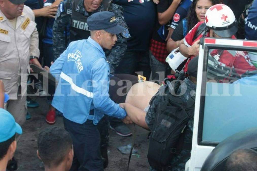 Fotos: Así ocurrió la mortal avalancha en el estadio Nacional durante la final del fútbol de Honduras