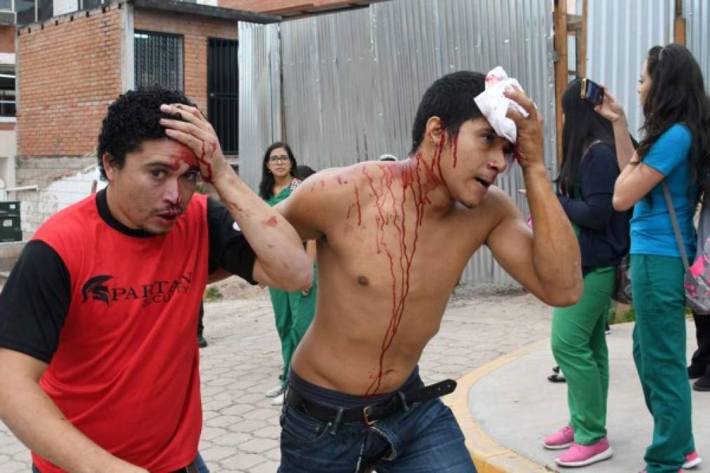 En Fotos: Así se vivió el zafarrancho entre universitarios y miembros de seguridad al interior de la UNAH