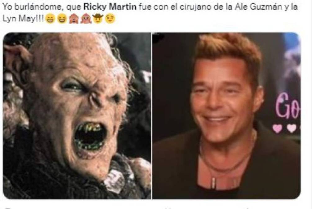 Ricky Martin se retoca la cara y desata una ola de memes