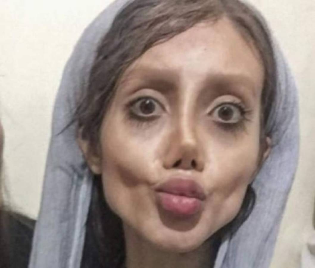 Joven de 19 años se somete a 50 cirugías para parecerse a Angelina Jolie