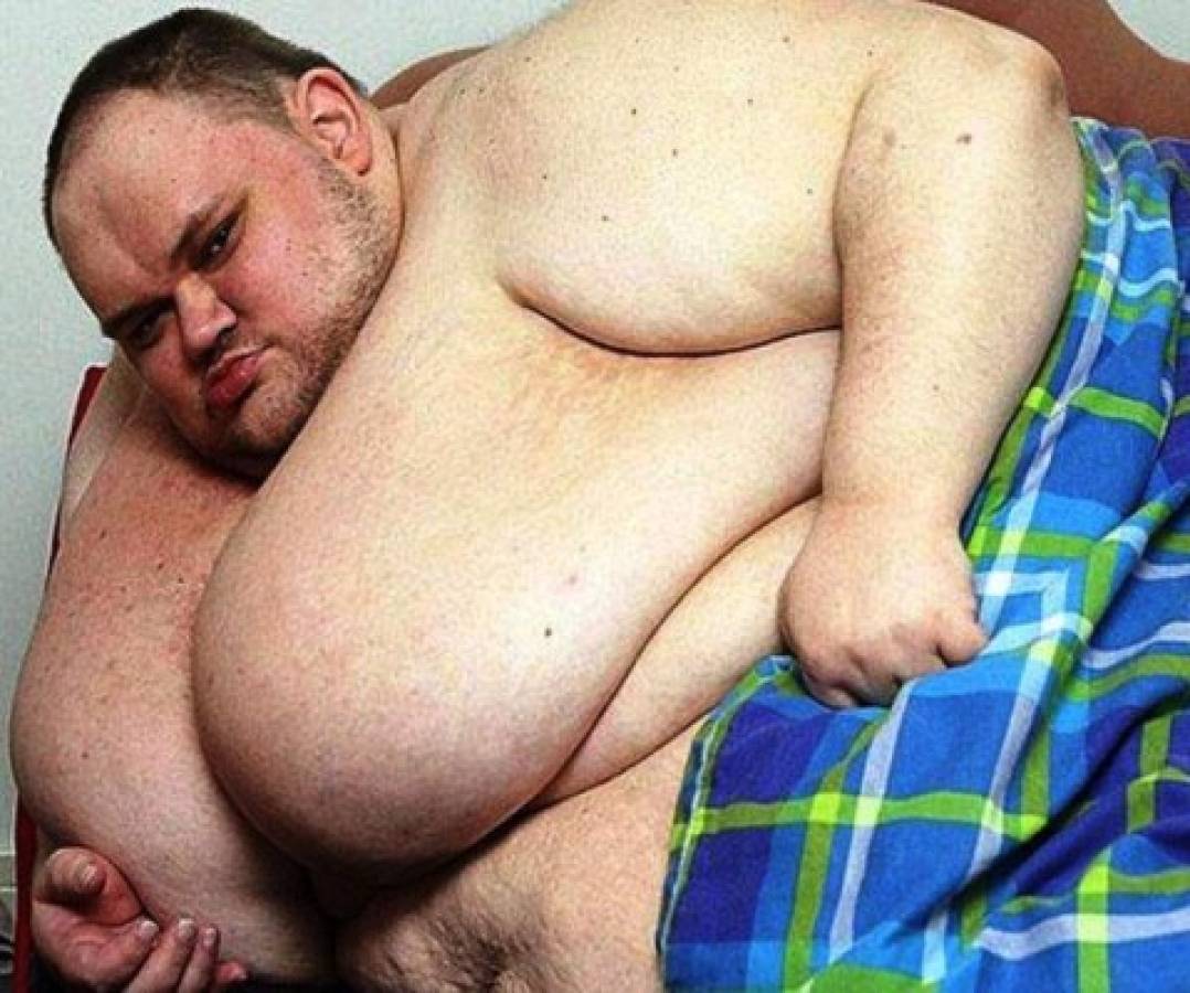 Falleció el hombre más obeso de Reino Unido