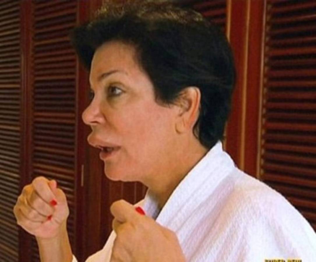 Kris Jenner apareció en TV con el labio desfigurado