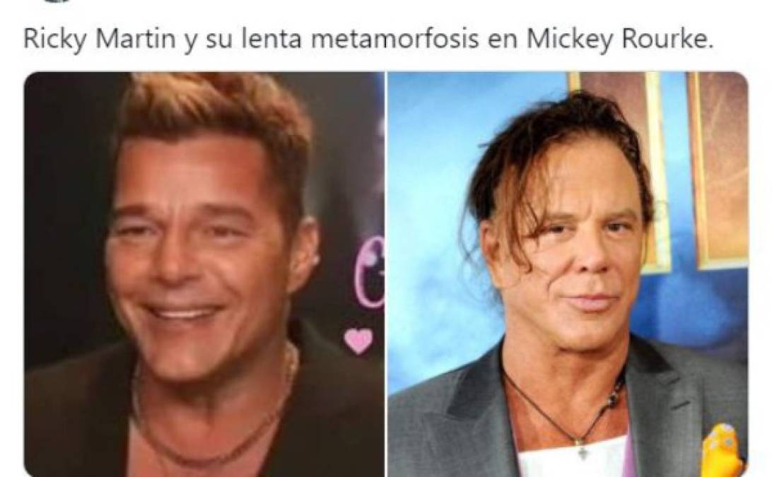 Ricky Martin se retoca la cara y desata una ola de memes