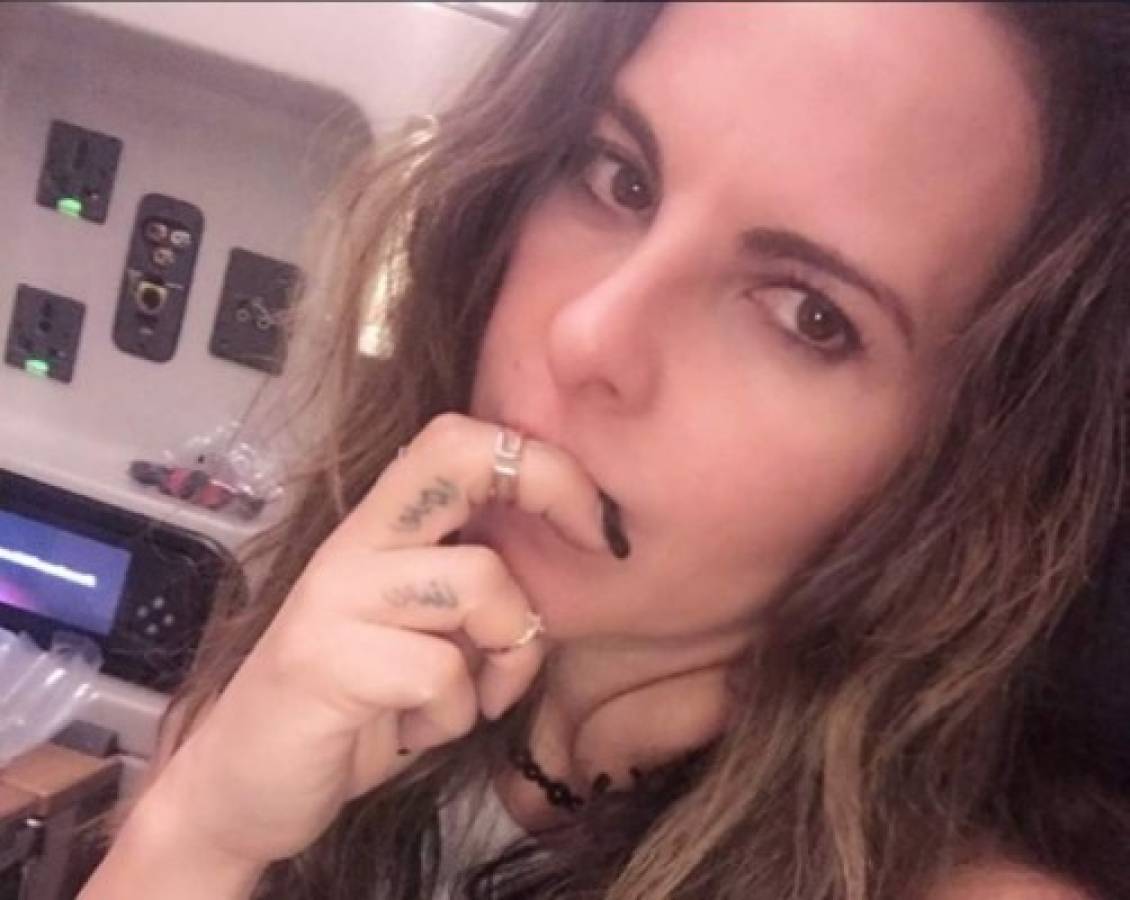 Kate del Castillo revela que utiliza Botox para mantenerse joven