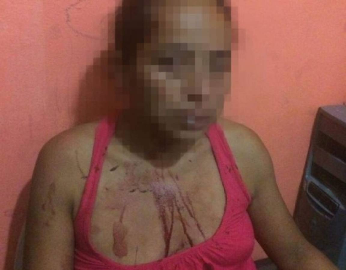 Hondureña denuncia maltratos por parte de sus hijas en Copán