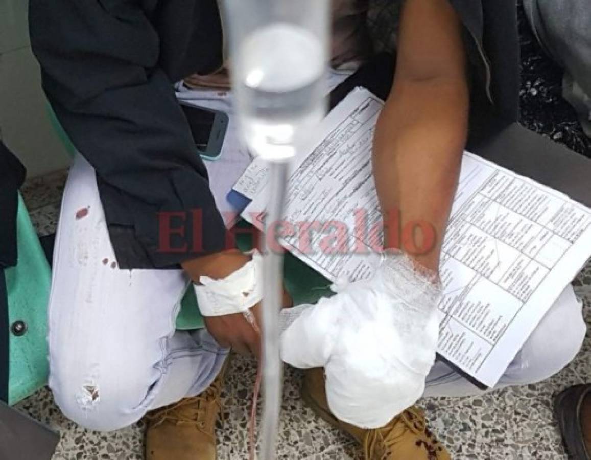 Joven pierde un dedo por explosión de mortero