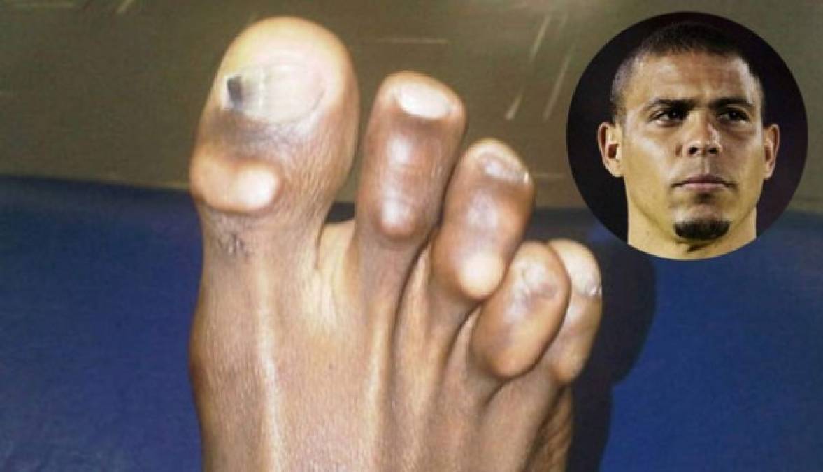 FOTOS: Los mejores futbolistas del mundo tienen los pies más feos