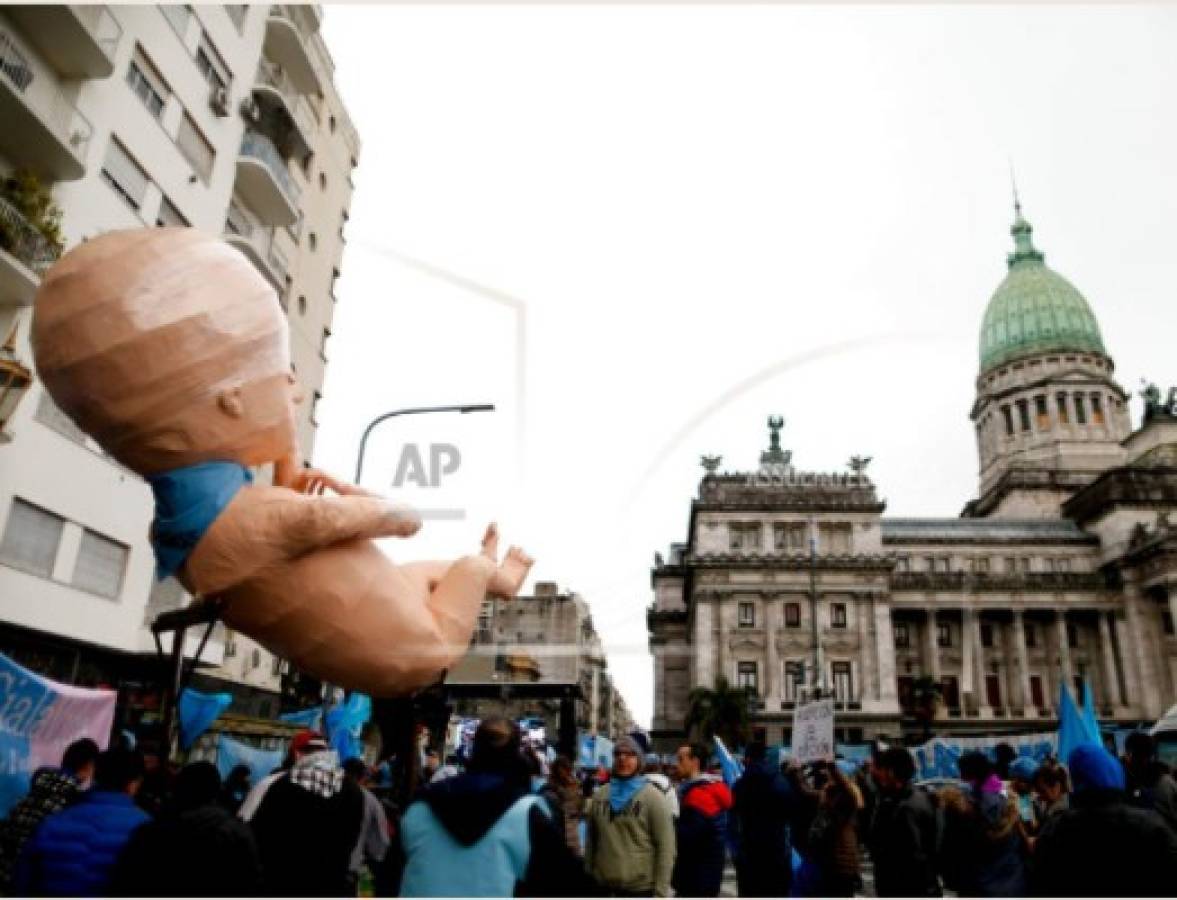 ¿Cuál es la situación del aborto en Argentina?