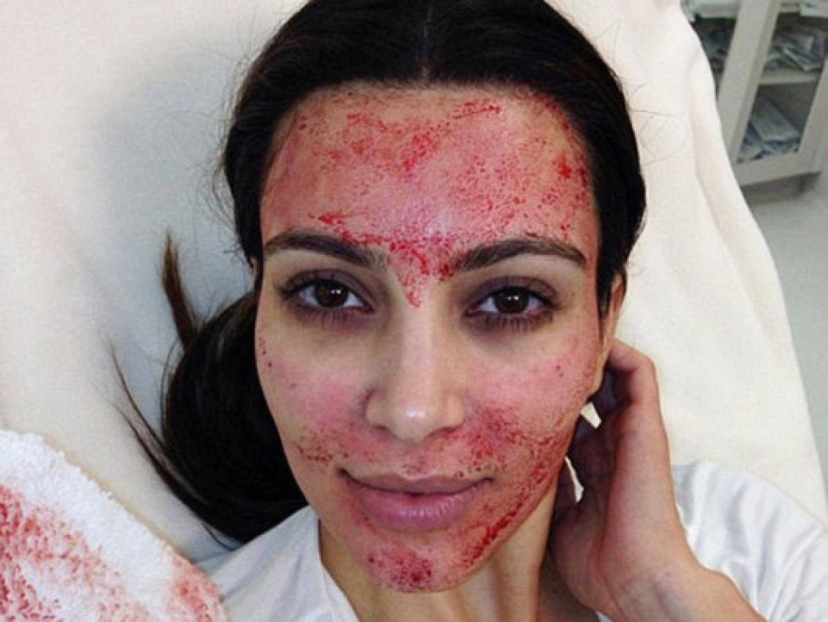 La cara ensangrentada de Kim Kardashian