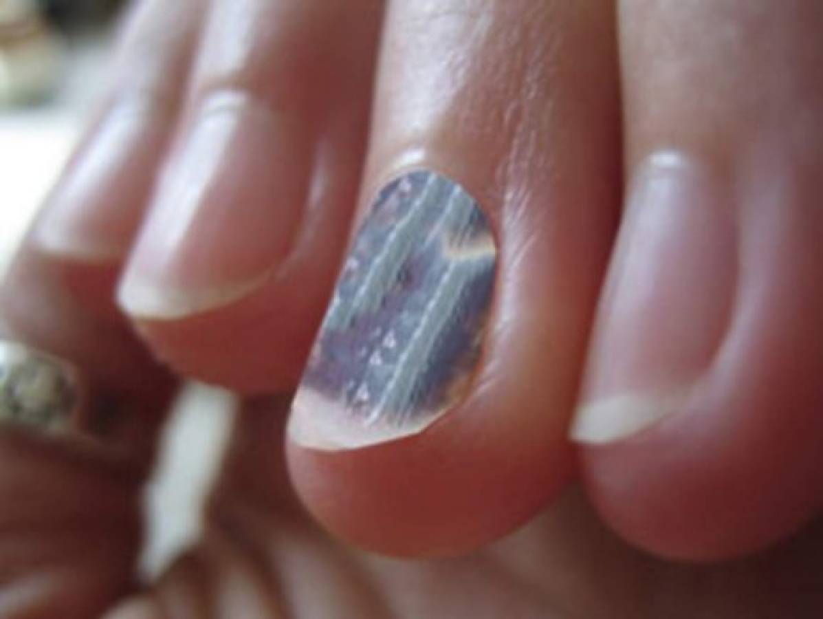 ¡Alerta! Las uñas moradas podrían indicar un grave problema en el organismo