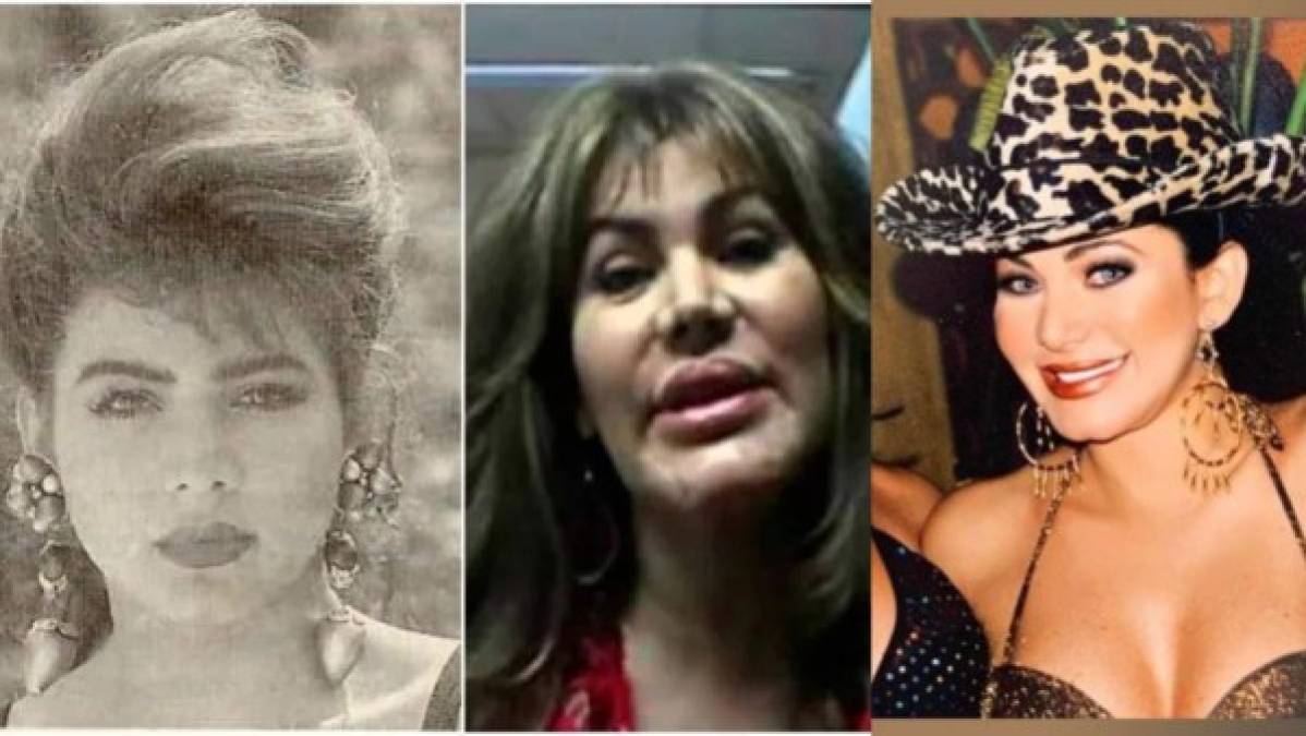 Las celebridades latinas que casi mueren por una mala cirugía estética