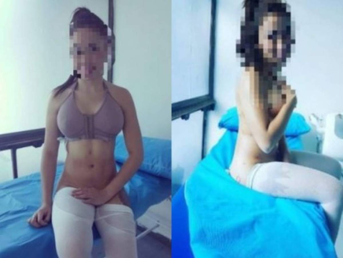 Roba aguinaldo a su marido para operarse el busto y los glúteos