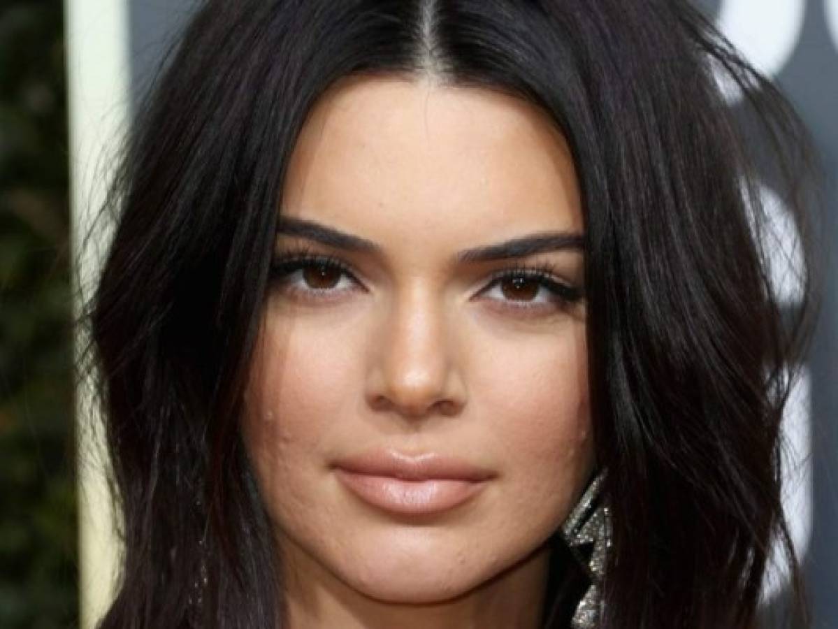 Kendall Jenner explota ante críticas por acné en los Globos de Oro 2018
