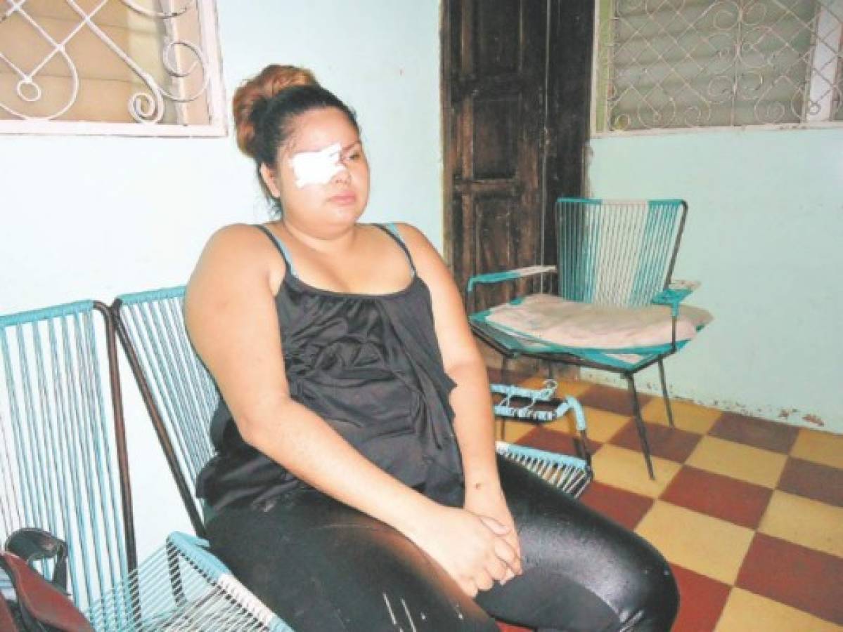 Hondureña que perdió el ojo por maltrato: 'Ninguna mujer debe permitir que la golpeen”