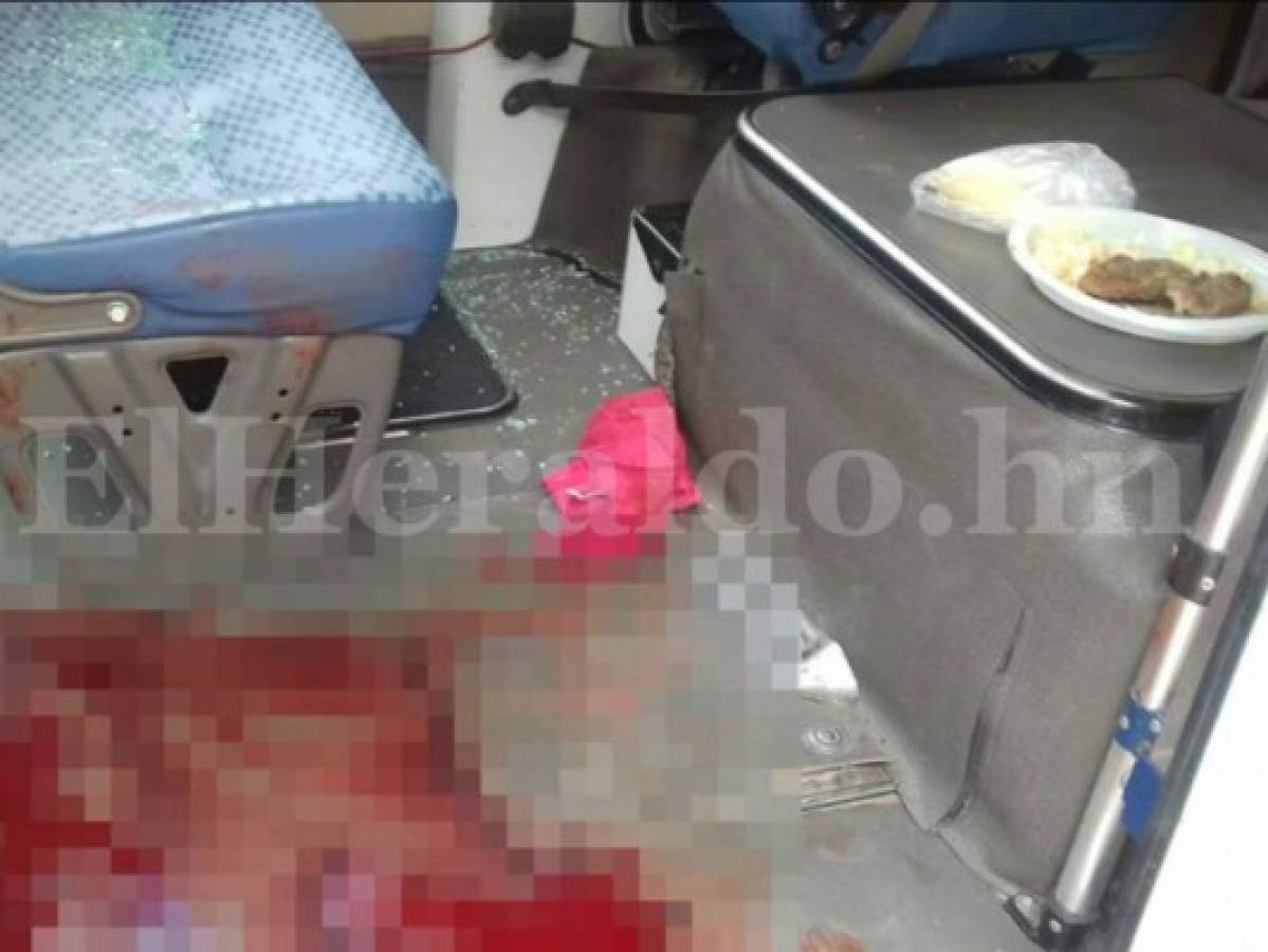 Tegucigalpa: Muere conductor de bus de El Sitio atacado mientras almorzaba