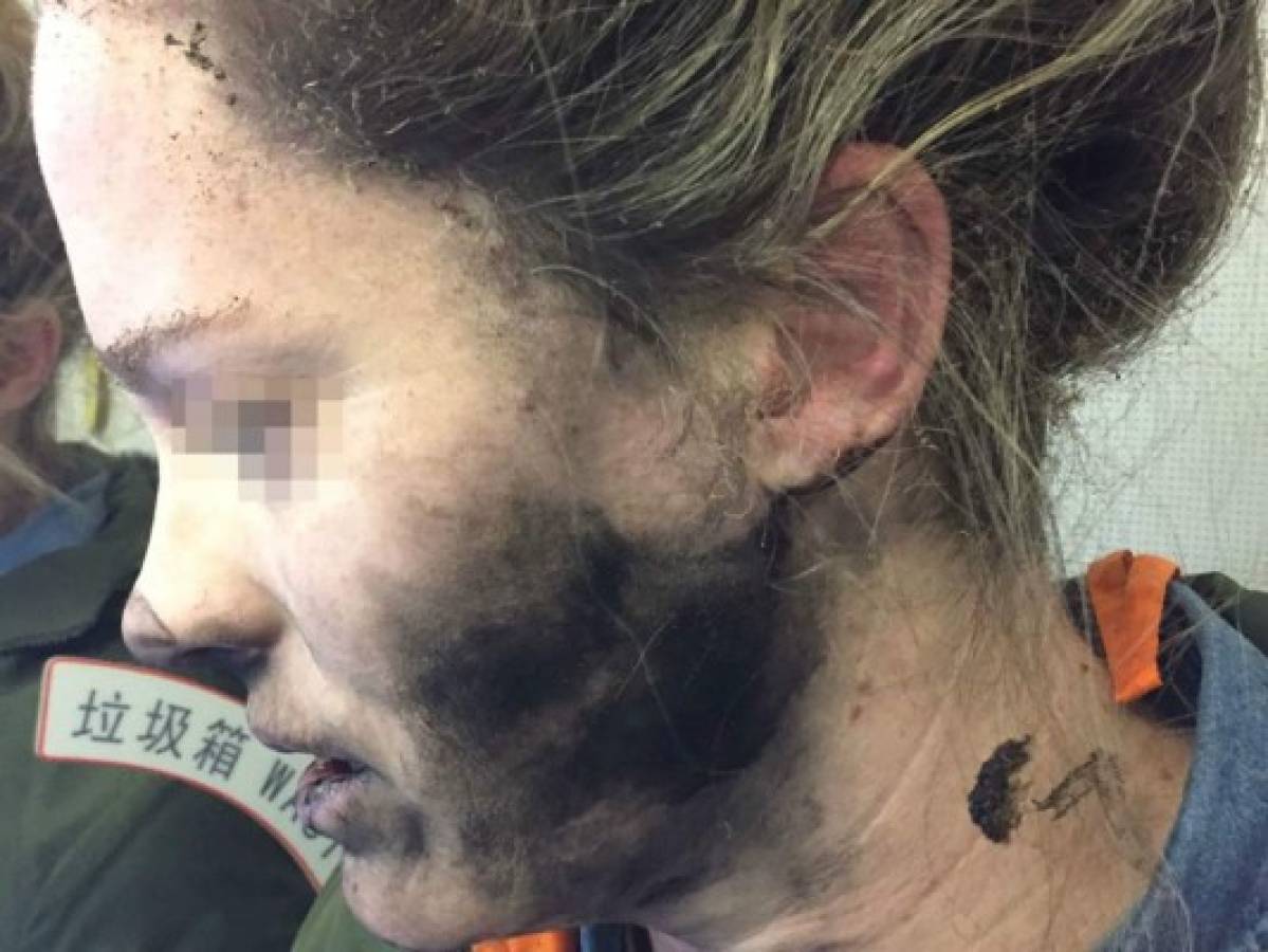 Una mujer sufre quemaduras por la explosión de sus auriculares en un vuelo a Australia
