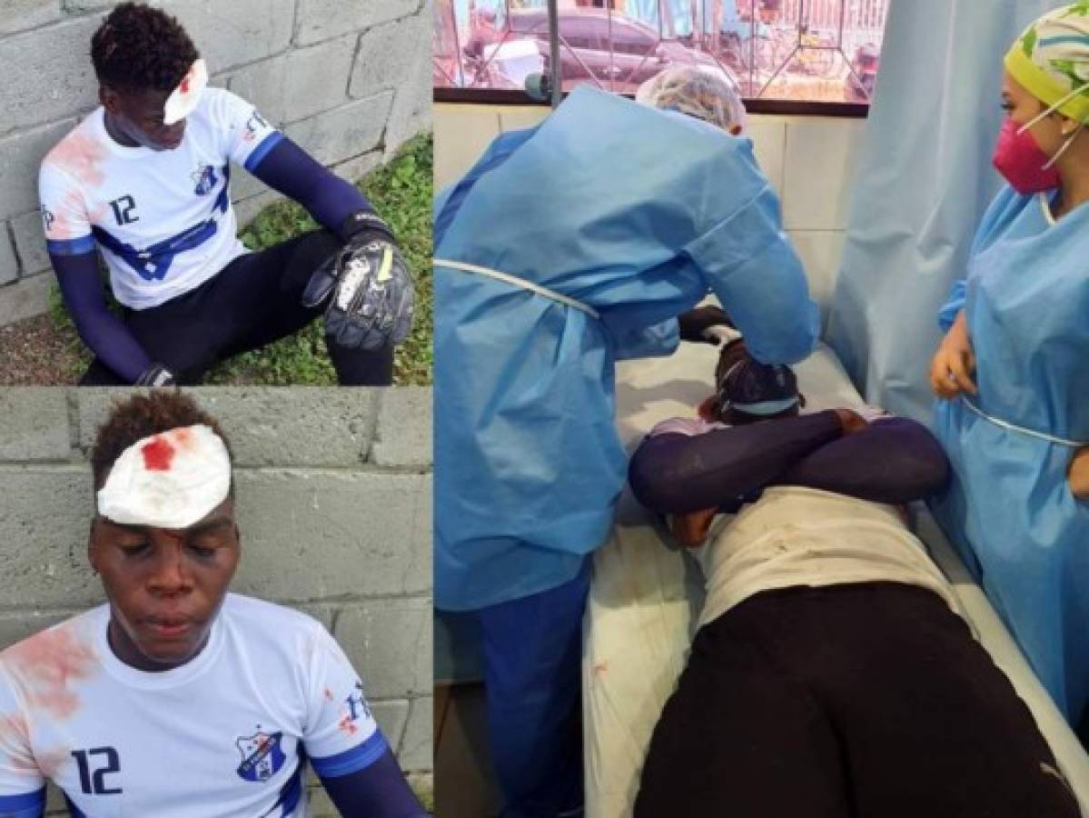 Portero del Honduras Progreso sufre terrible golpe en entrenamiento