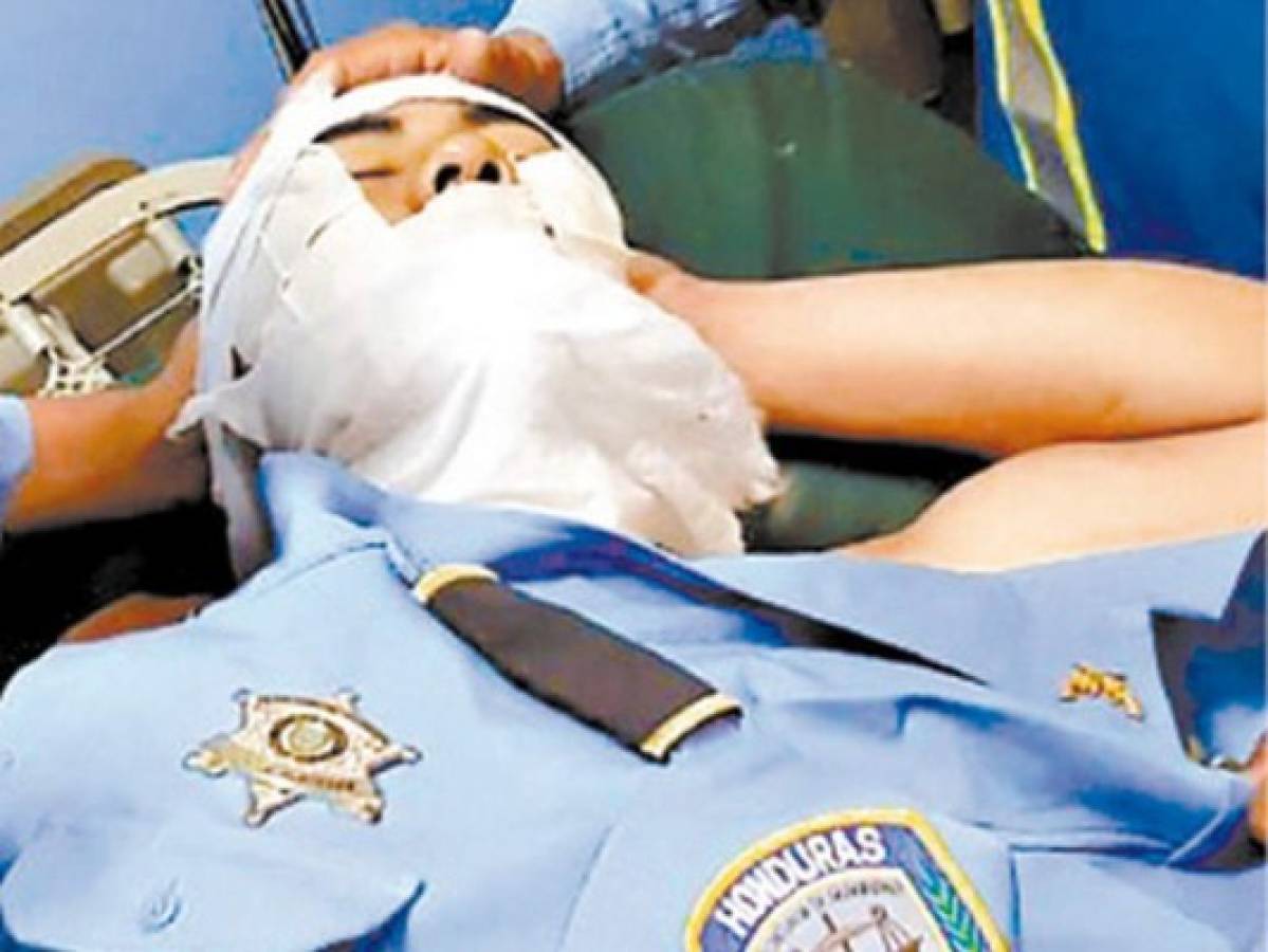 Policías atacados con potasa están delicados de salud