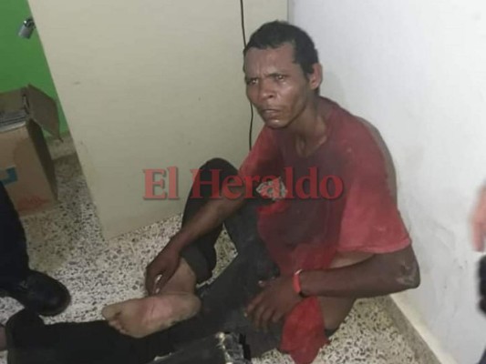 Capturan a presunto psicópata que macheteó a varias personas en Catacamas