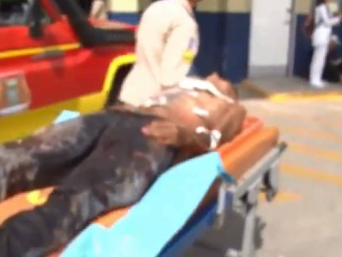 Una persona herida deja tiroteo en la colonia El Carrizal  