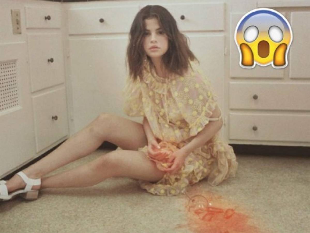 ¡Al descubierto! Exnovio de Selena Gómez sufrió las consecuencias de su relación con la cantante