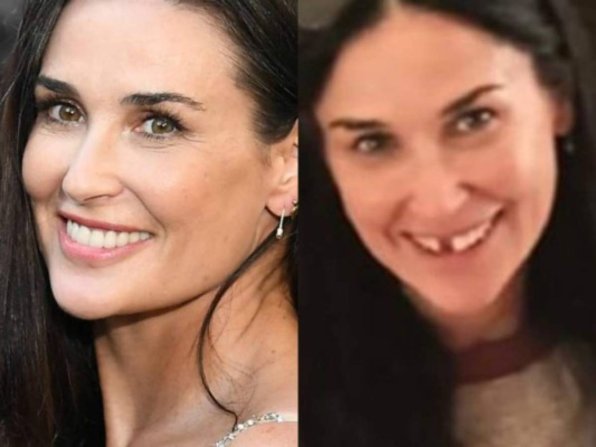 Revelación en programa de Jimmy Fallon: ¿Por qué la actriz Demi Moore perdió dos dientes frontales?