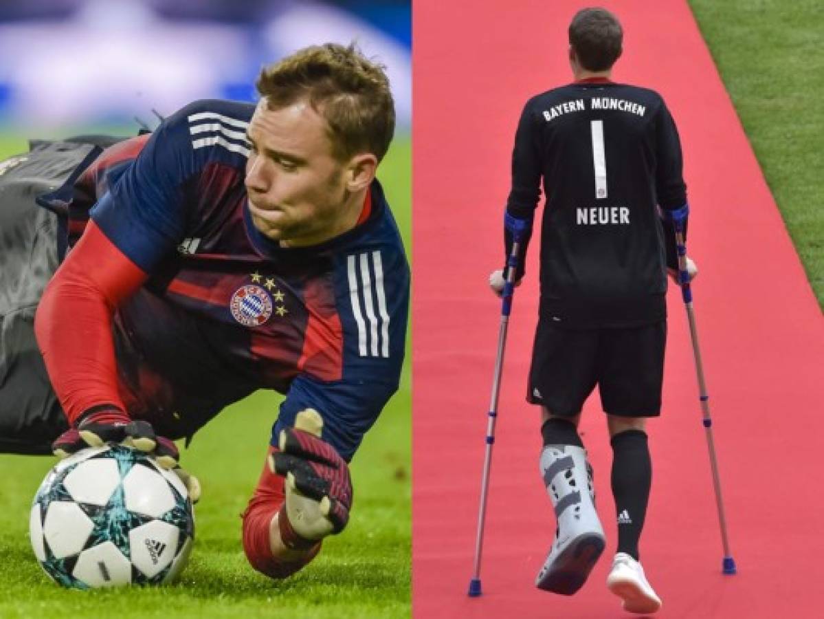El estado de Manuel Neuer sigue generando dudas para el Mundial de Rusia 2018