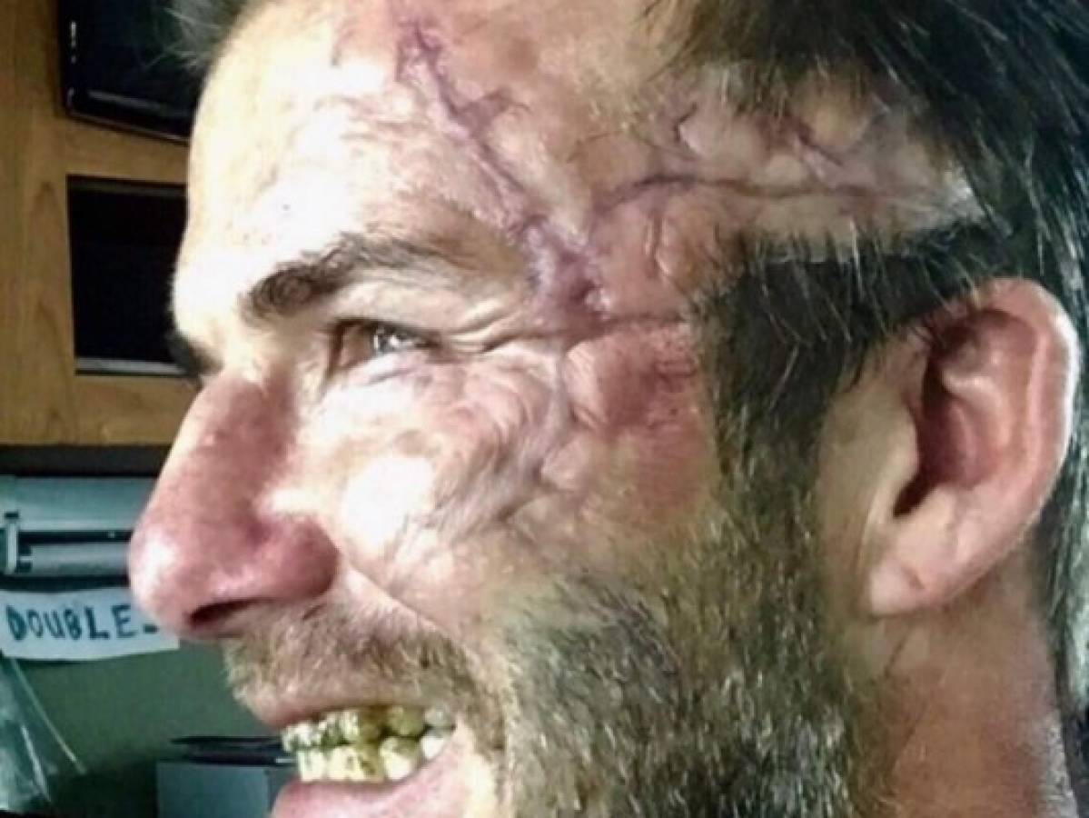 David Beckham sorprende a sus fans al publicar una foto con la cara desfigurada