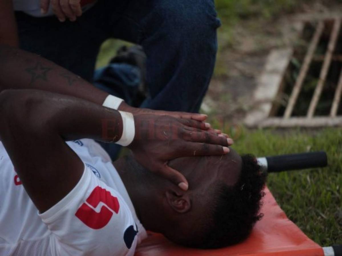 Olimpia: John Paul Suazo estará de baja tres meses por fractura en la tibia  