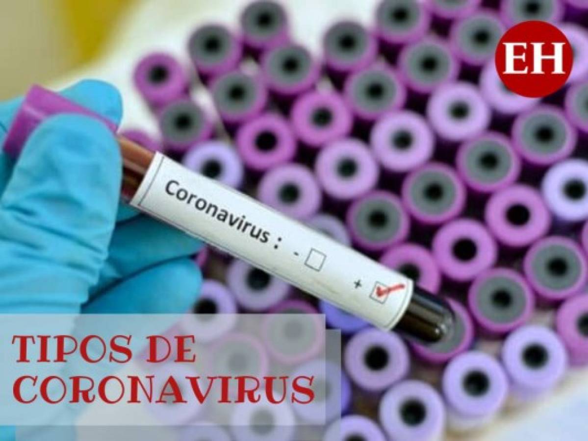 ¿Cuántos tipos de coronavirus hay capaces de generar epidemias?