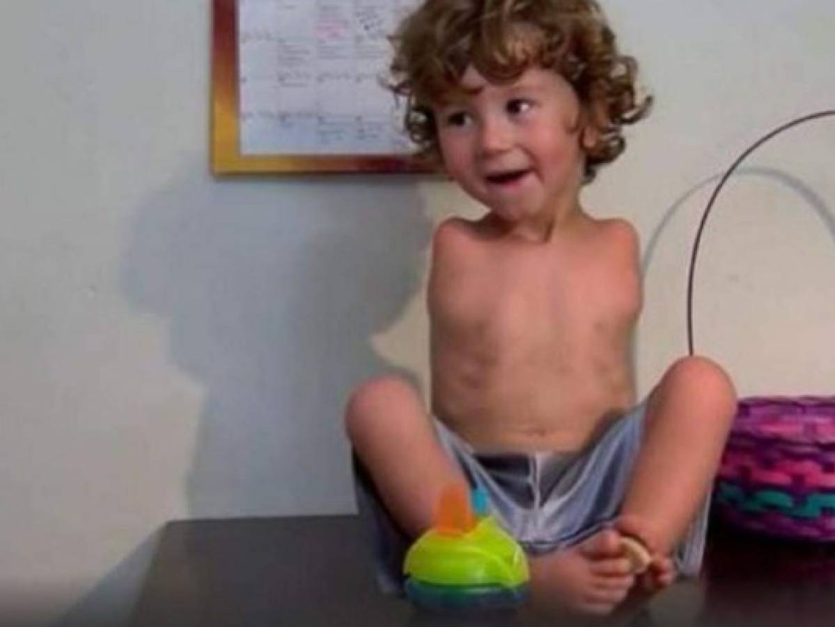 Discriminan a un niño sin brazos por 'comer con los pies' y lo corren de un restaurante