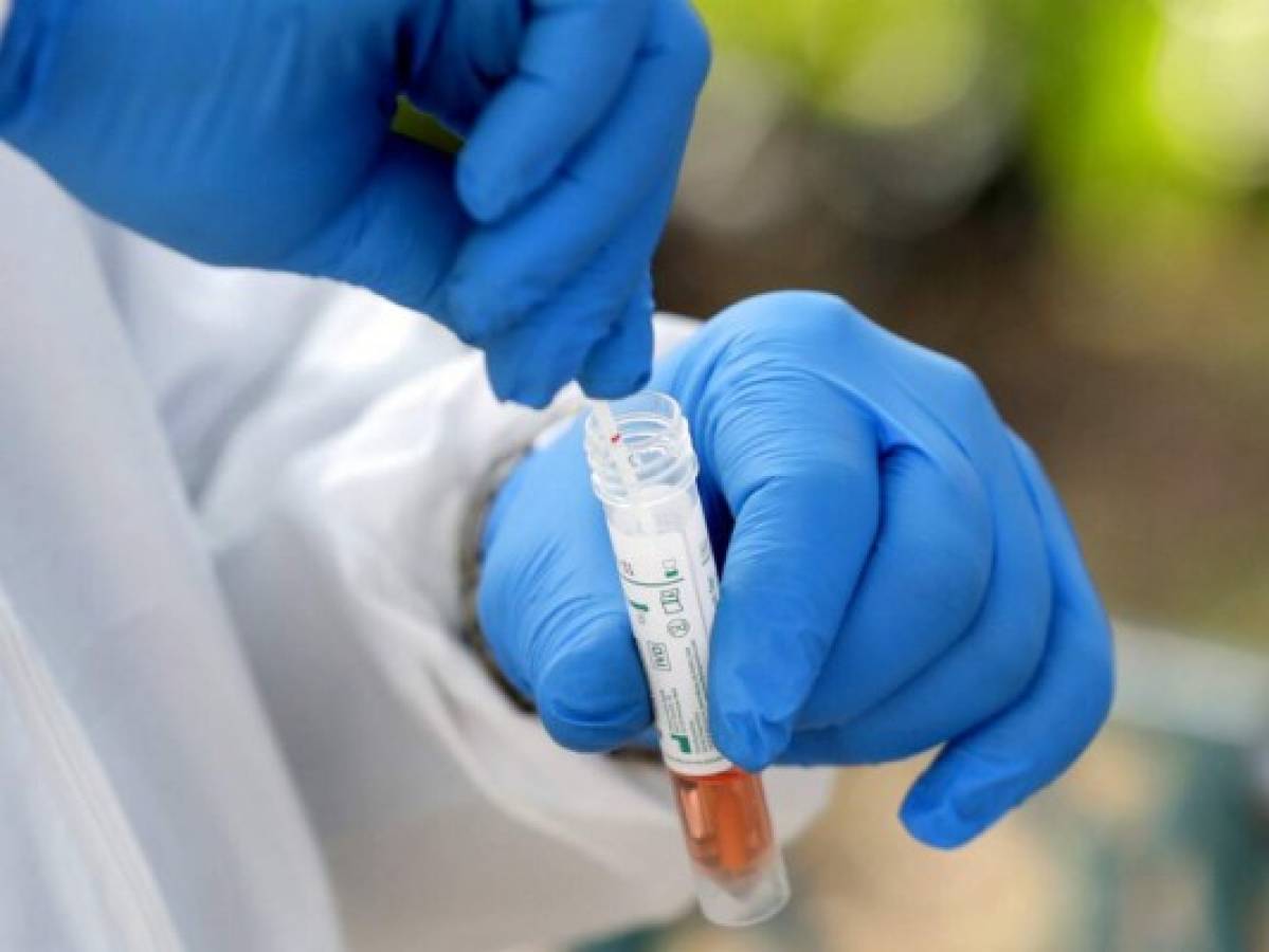 Silencio epidemiológico de coronavirus pasará factura a Honduras