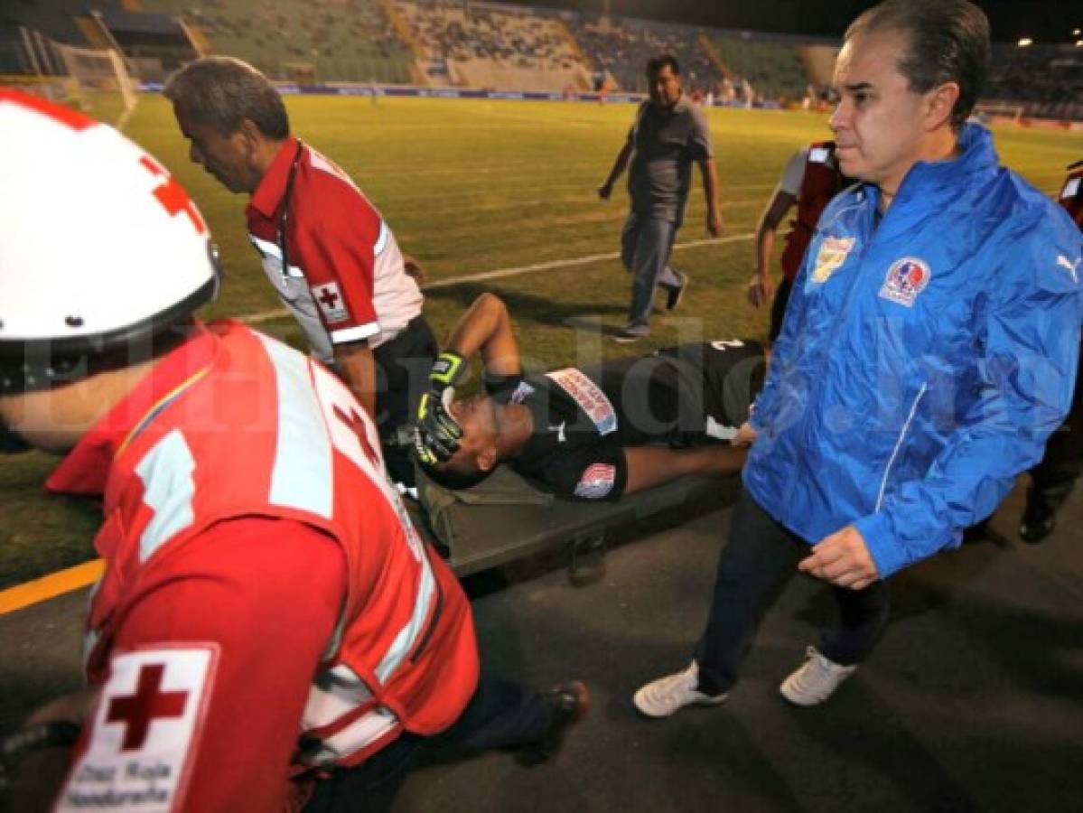 ¡ALARMA! Donis Escober se fracturó el pómulo derecho y será operado esta noche