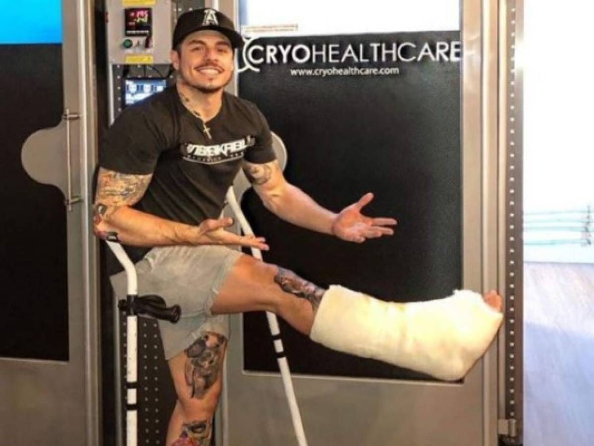 Casper Smart muestra cómo quedó su pie tras una fractura