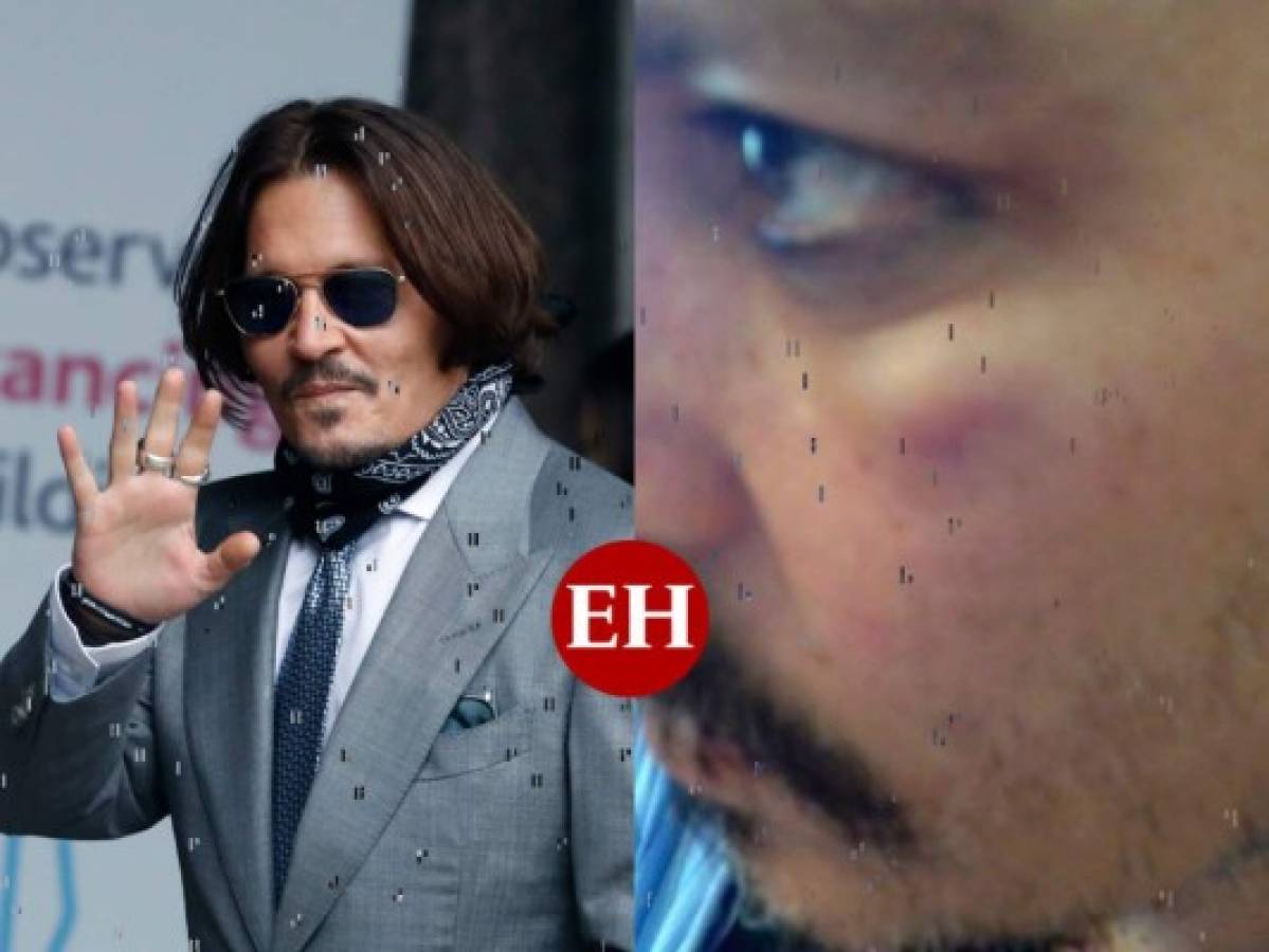 Foto de golpe de Johnny Depp muestra abusos de Amber Heard, dice guardia  