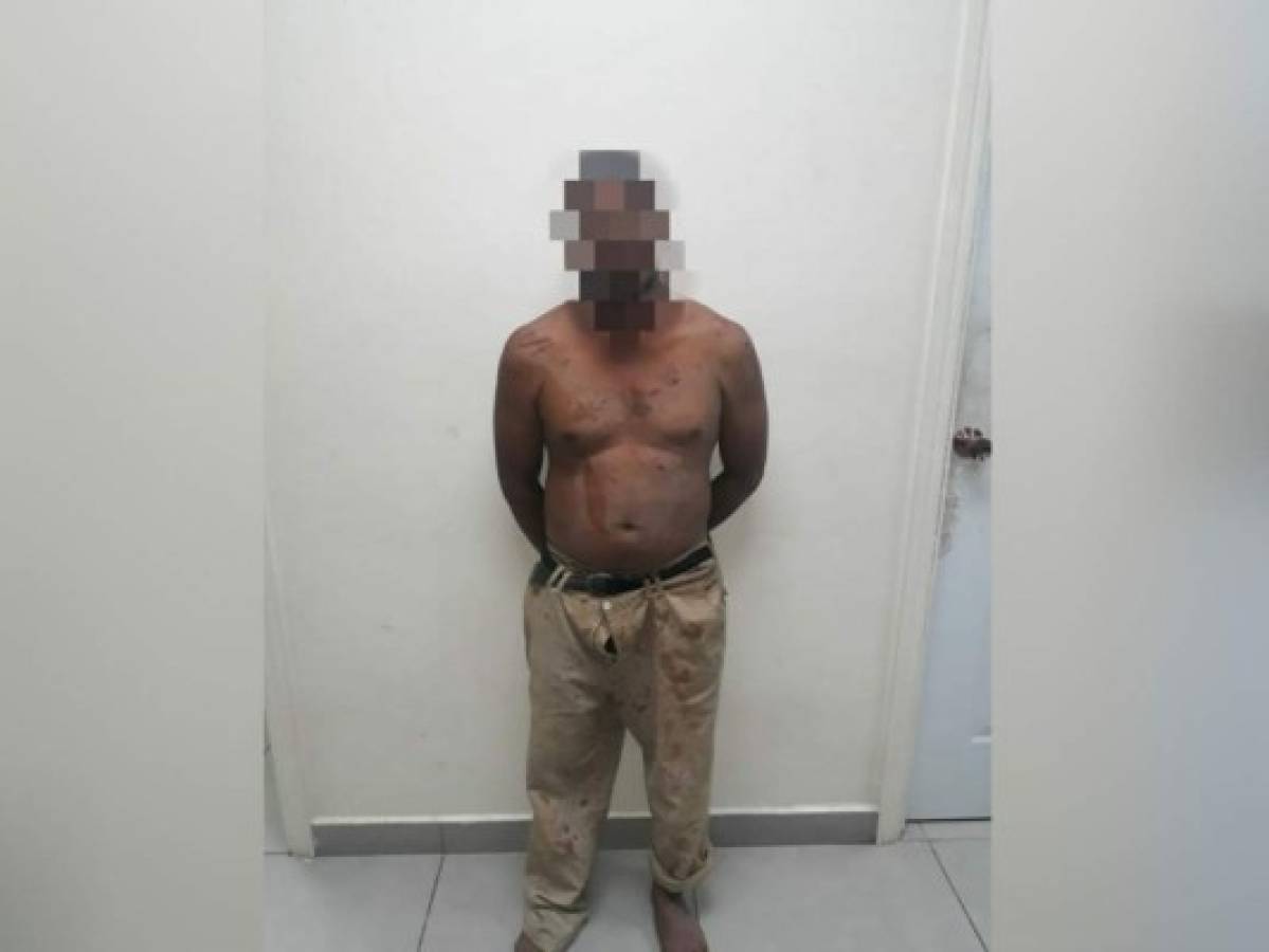 Hombre asesina a su tío a machetazos en Jutiapa, Atlántida