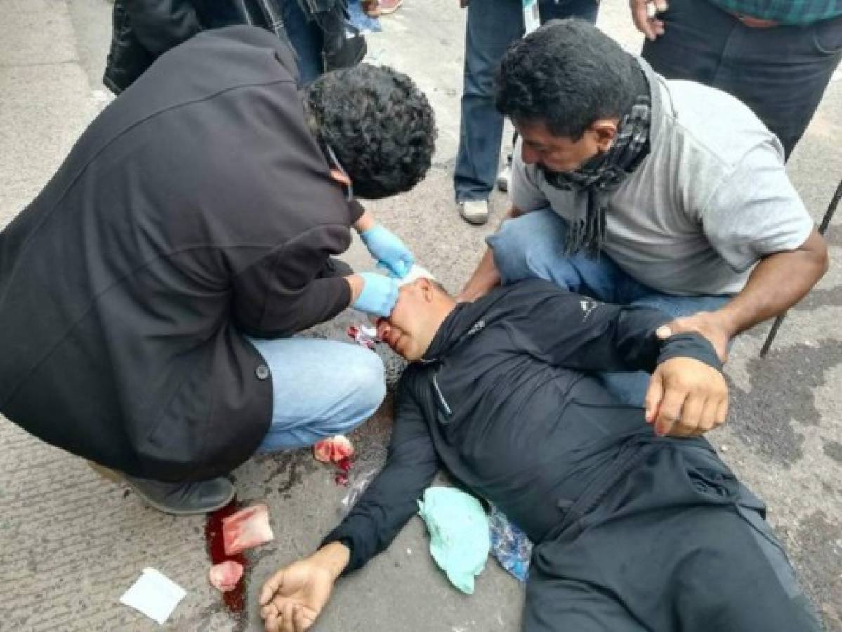 Conadeh pide investigar muerte de manifestantes durante protestas durante proceso electoral