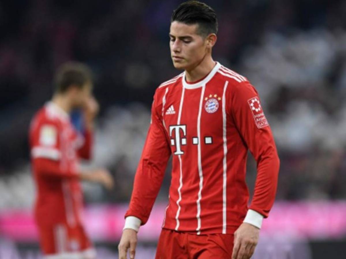 James Rodríguez sufre dura lesión que lo tendría en las canchas hasta el 2019