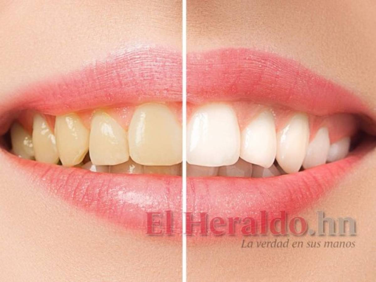 Cinco consejos para cuidar tus dientes y garantizar la higiene bucal