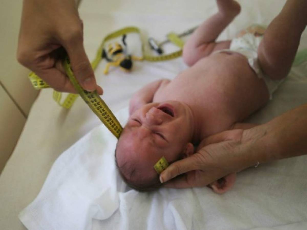 Bebés normales pueden desarrollar microcefalia el primer año por el zika