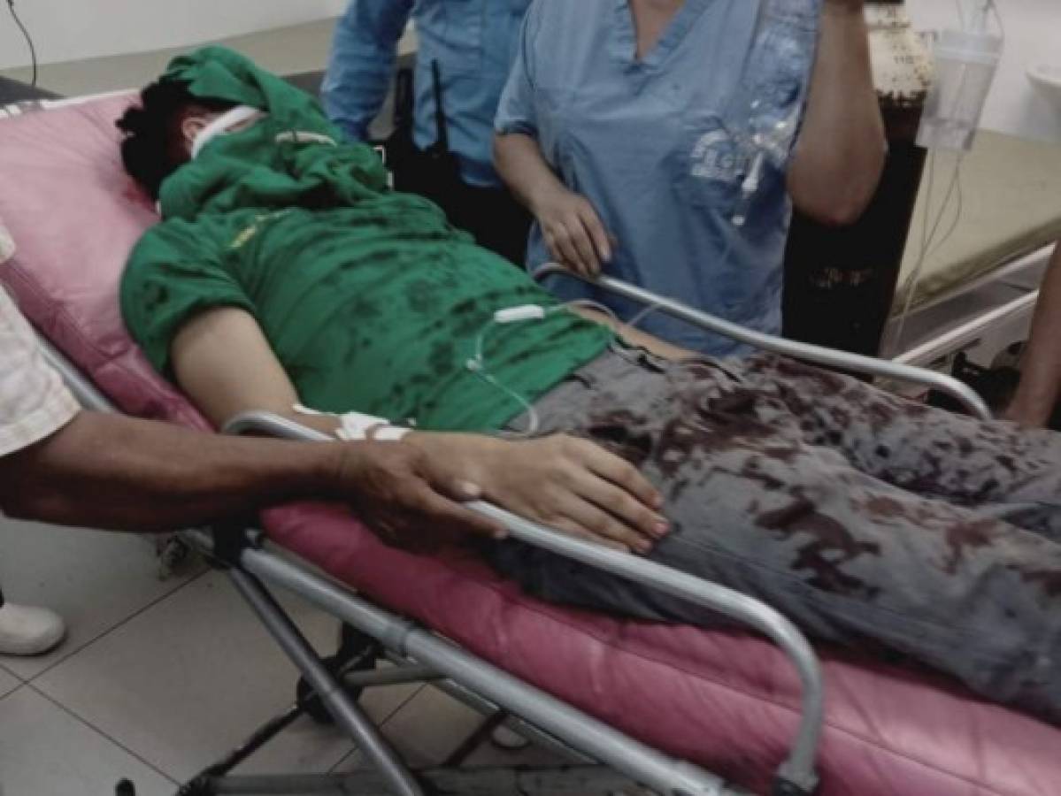 ¡Repudiable! Joven termina con el rostro destruido tras ataque con artefacto explosivo en Choluteca