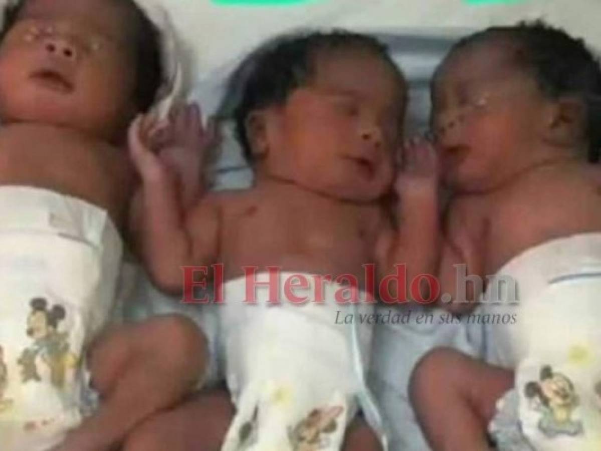 Nacen trillizos en el Hospital Mario Catarino Rivas de SPS