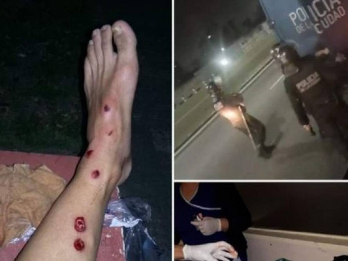 Primo de Jonatan Maidana terminó con pierna herida tras caos en Lanús