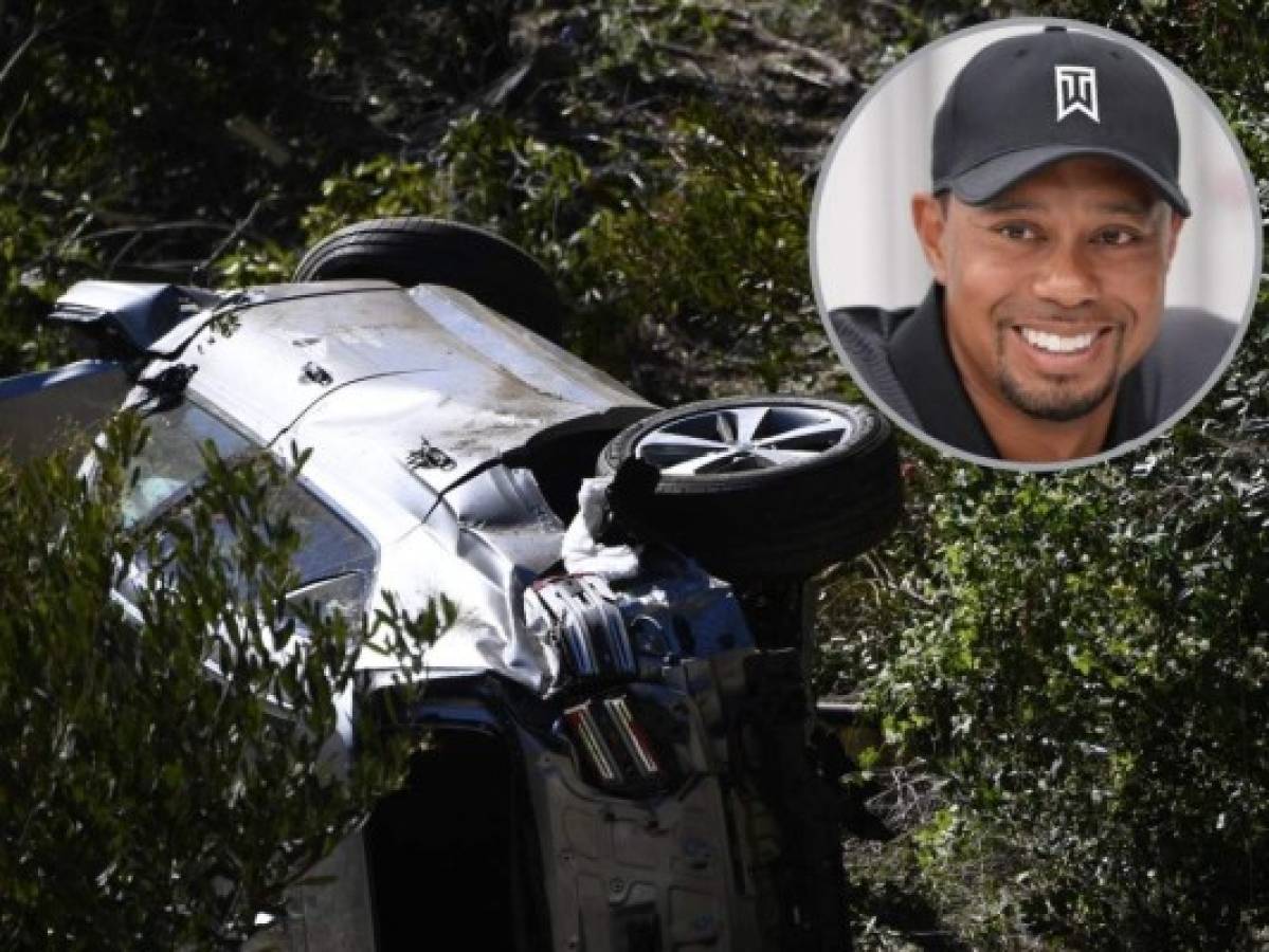 Tiger Woods fue hallado 'consciente' y con graves heridas en las dos piernas
