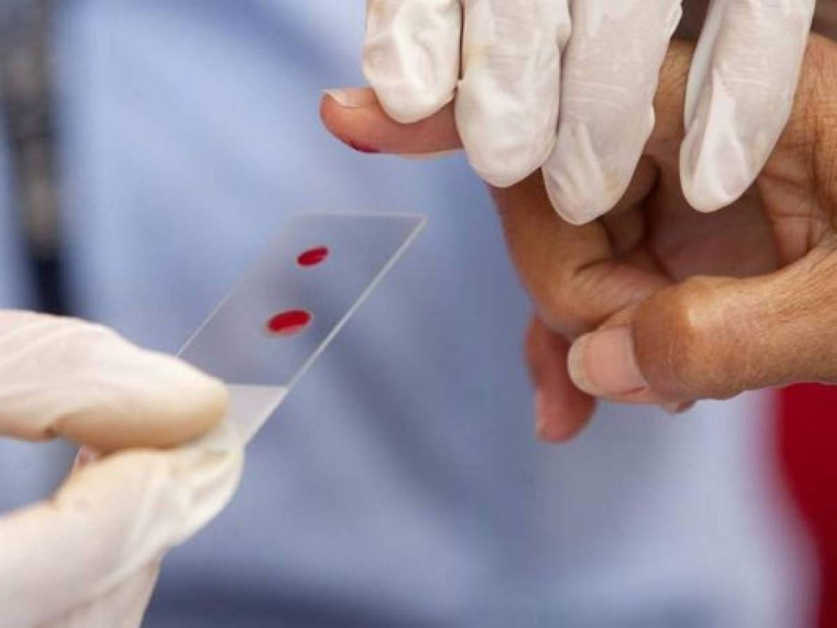 EEUU levanta prohibición que impedía a los gays donar sangre de por vida