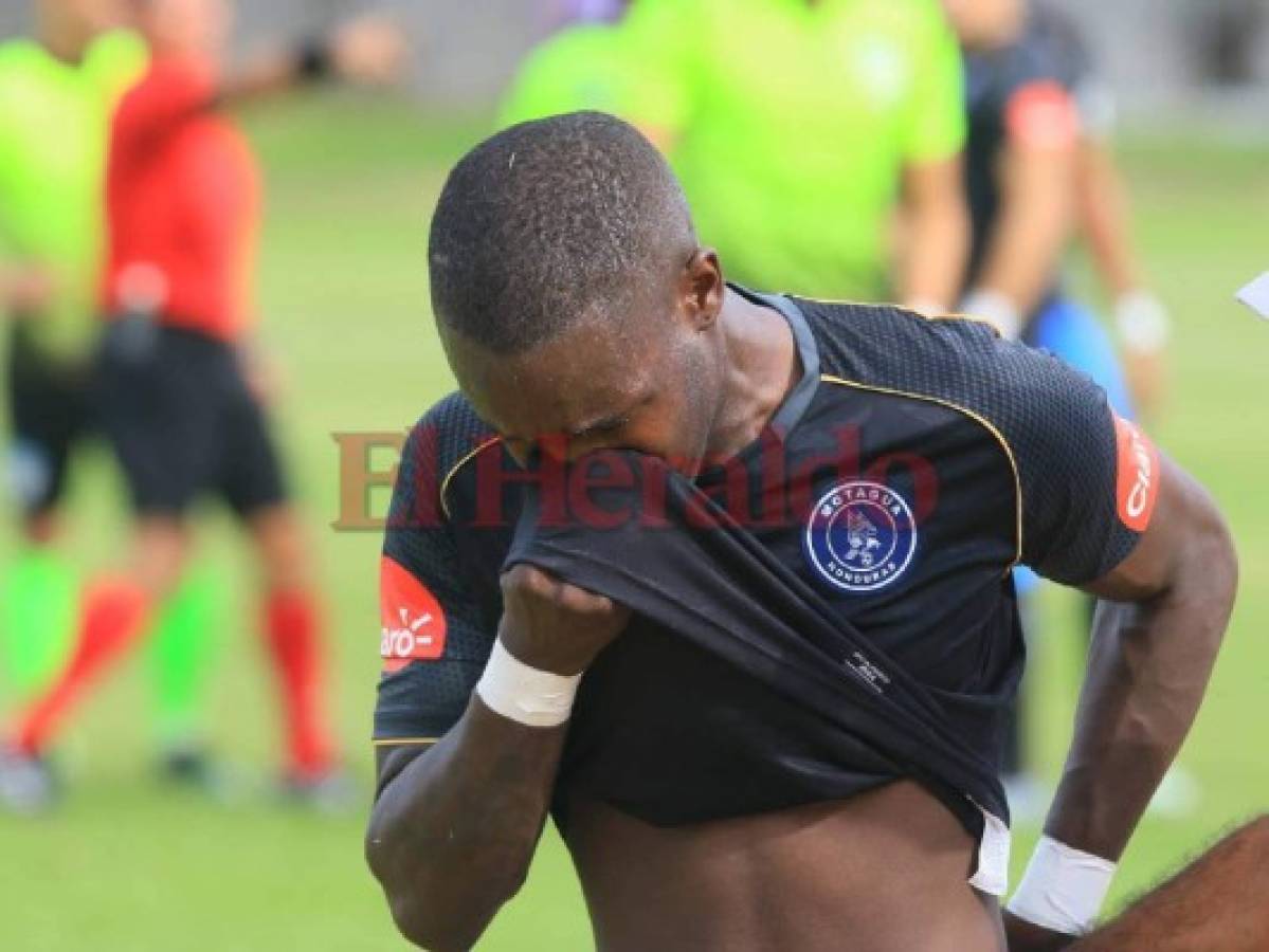 Rubilio Castillo salió lesionado en el juego Real de Minas vs Motagua en Danlí