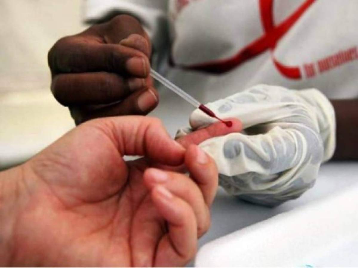 Dificultades para eliminar la tuberculosis y el VIH en el mundo