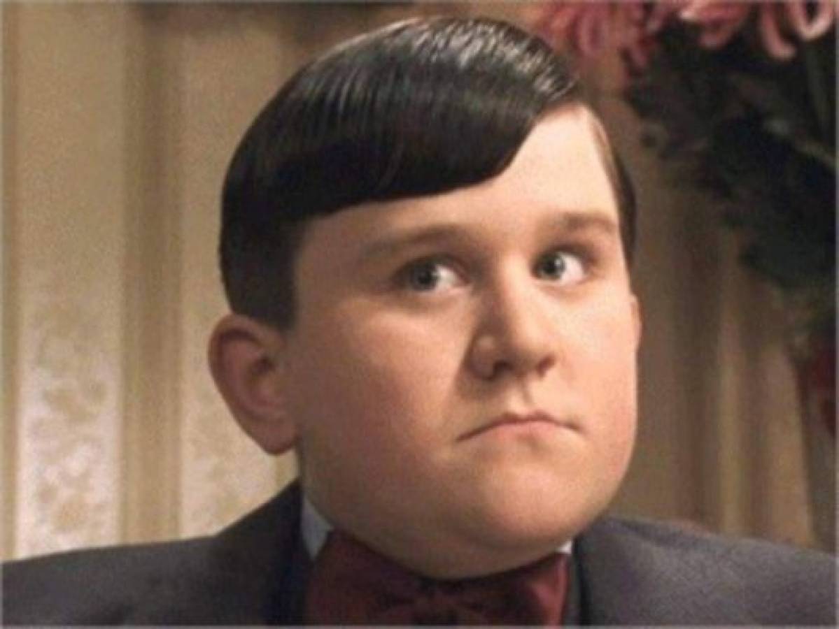 El increíble cambio de Harry Melling actor de Harry Potter